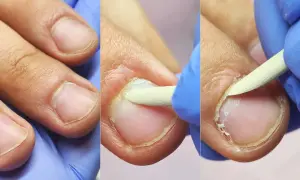 Manicure męski na czym polega? Poznaj etapy i zyskaj zdrowe dłonie