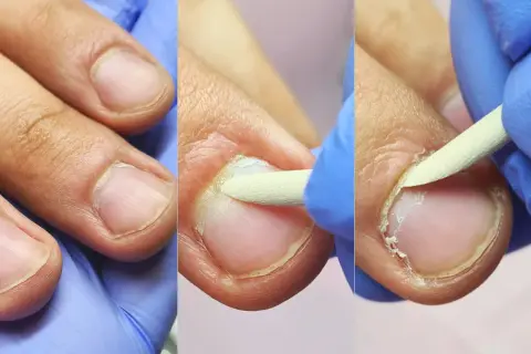Manicure męski na czym polega? Poznaj etapy i zyskaj zdrowe dłonie