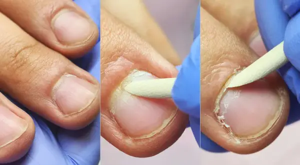 Manicure męski na czym polega? Poznaj etapy i zyskaj zdrowe dłonie